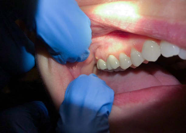 Best Weekend Emergency Dentist in Liberty, KY