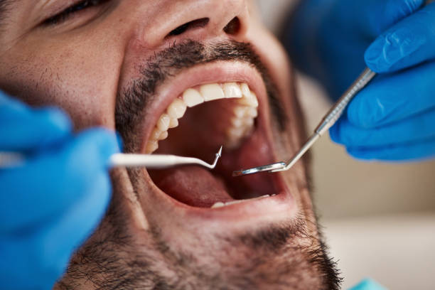 Best Emergency Denture Repair in Liberty, KY