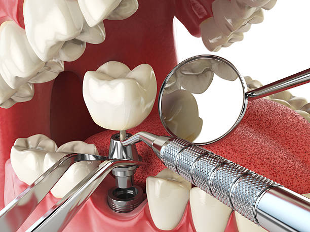 Best Emergency Dental Care for Broken or Chipped Teeth in Liberty, KY